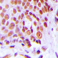 Polyclonal Rabbit anti-Human CEBPG / CEBP Gamma Antibody (Internal, IHC, IF, WB)