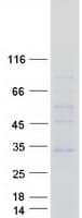 Human CLN6 Protein (Recombinant Myc-DDK (Flag))