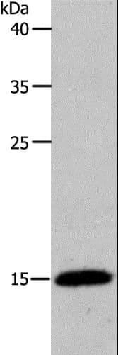 Polyclonal Rabbit anti-Human PFN2 / Profilin 2 Antibody (IHC, WB)