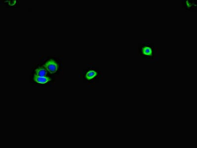 GK / Glycerol Kinase Antibody