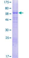 Human SLC39A8 / ZIP8 Protein (Recombinant GST)