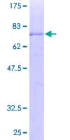 Human CHST12 Protein (Recombinant GST)