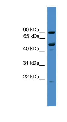 MB21D2 Antibody (C-Terminus)