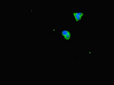 PRDX2 / Peroxiredoxin 2 Antibody