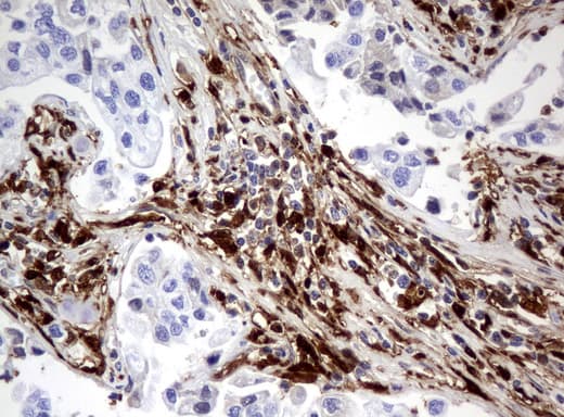 TP / Thymidine Phosphorylase Antibody (aa311-482, clone UMAB97, Carrier-free)