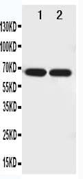 NTN1 / Netrin 1 Antibody (aa32-51)