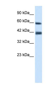 TRIM31 / RNF Antibody (aa117-166)