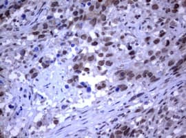 RASGRP3 / GRP3 Antibody (clone OTI2G7)