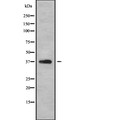 Polyclonal Rabbit anti-Human GNB1 Antibody (WB)