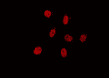 PLK5 Antibody