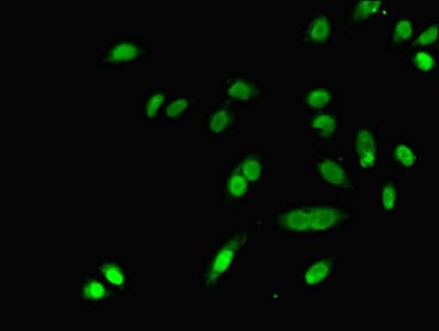 IHC-plus™ Polyclonal Rabbit anti-Human DHRS9 Antibody (IHC)