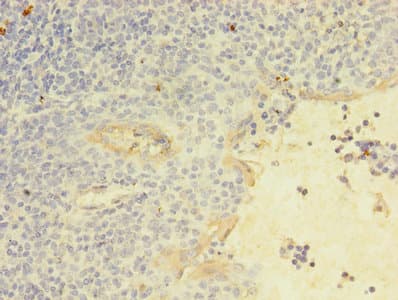 Polyclonal Rabbit anti-Human KLRC2 / NKG2C / CD159c Antibody (aa94-231, IHC)