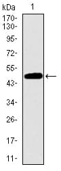 Monoclonal Mouse anti-Human TP53BP1 / 53BP1 Antibody (clone 6B3E10, aa574-773, IHC, WB)