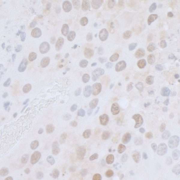 Polyclonal Rabbit anti-Human CTR9 Antibody (aa1123-1173, IHC, WB)