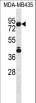 IHC-plus™ Polyclonal Rabbit anti-Human SGPL1 Antibody (aa72-101, IHC, WB)