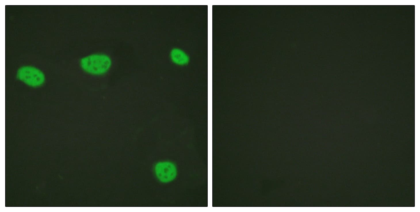 IHC-plus™ Polyclonal Rabbit anti-Human Vitamin D Receptor / VDR Antibody (aa181-230, IHC, IF, WB)