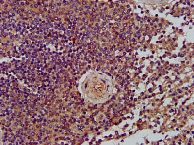 LRPPRC Antibody