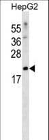 SRSF3 / SRP20 Antibody (aa82-110)