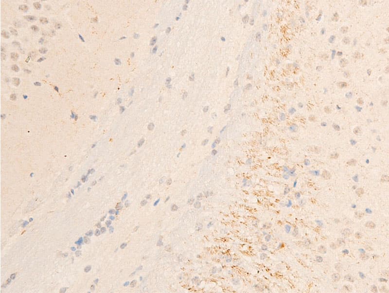 Polyclonal Rabbit anti-Human SYK Antibody (phospho-Tyr323, IHC, IF, WB)