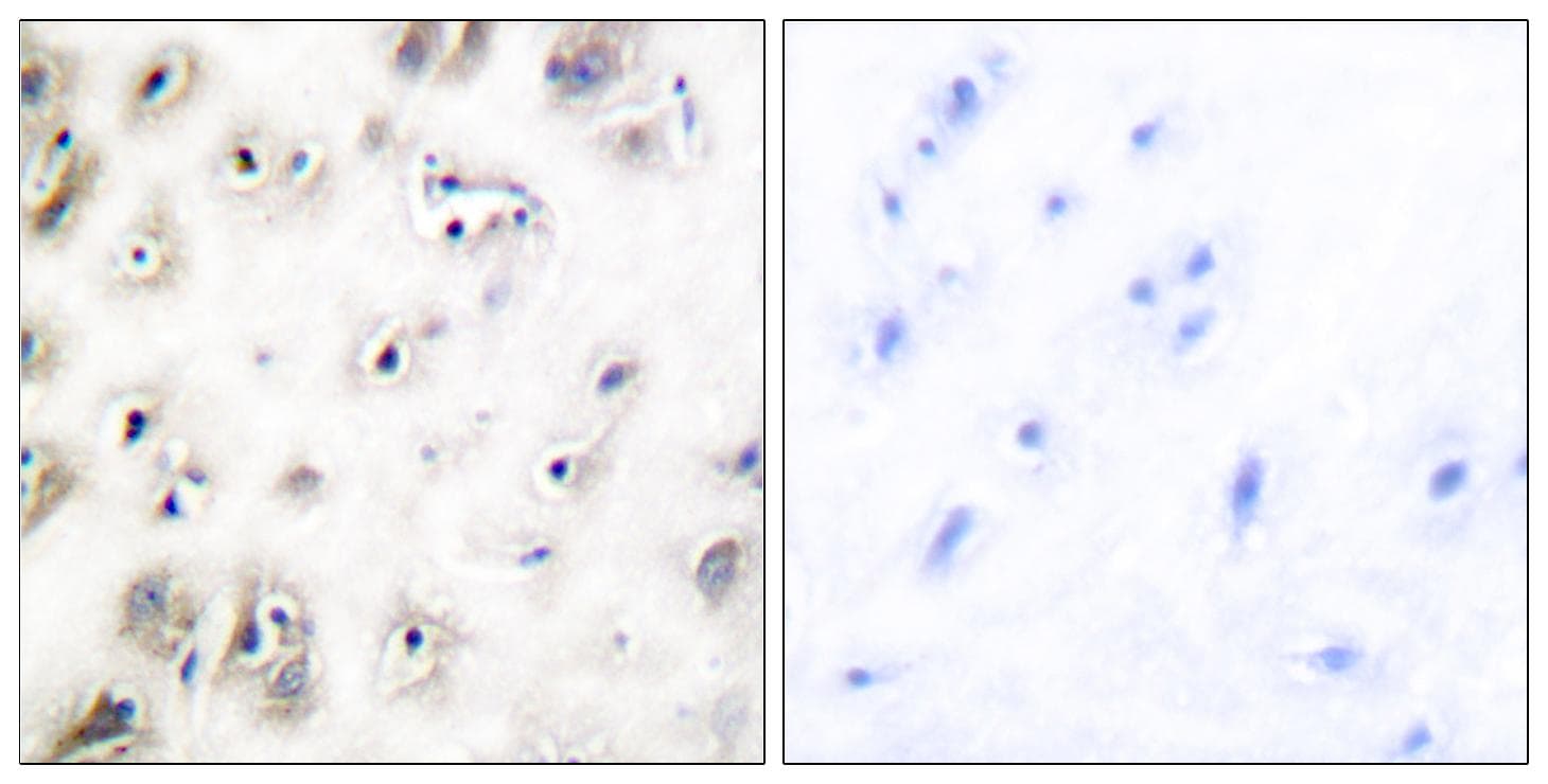 IAPP / Amylin Antibody
