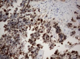 Monoclonal Mouse anti-Human MKI67 / Ki67 Antibody (clone OTI1F11, Carrier-free, aa1160-1493, IHC, WB)