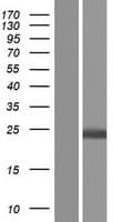 HPCA / Hippocalcin Protein (Over-Expression Lysate Myc-DDK (Flag))