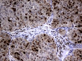 Monoclonal Mouse anti-Human PCNA Antibody (clone OTI1D11, IHC, WB)