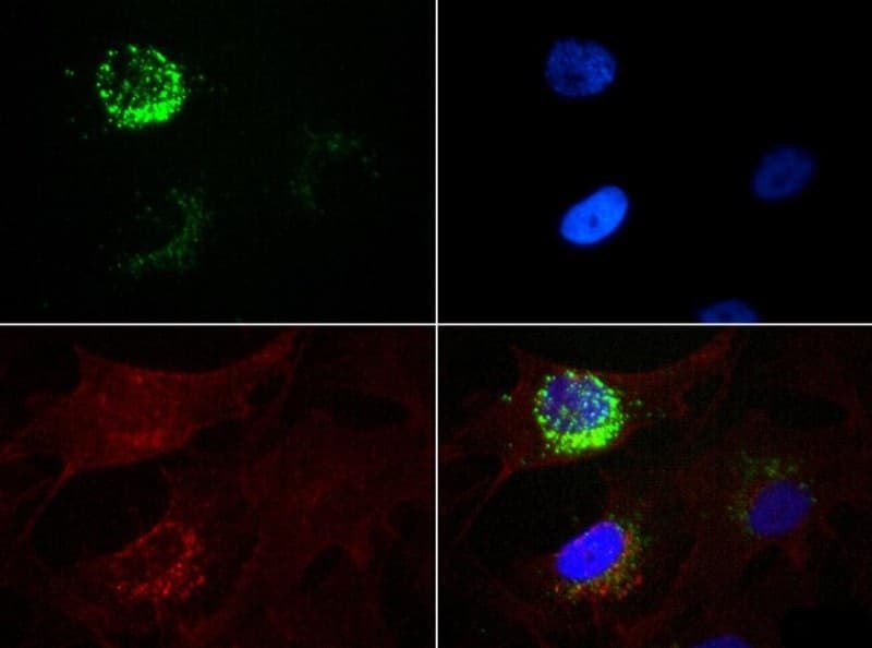 Monoclonal Mouse anti-Human STRO-1 Antibody (clone STRO-1)