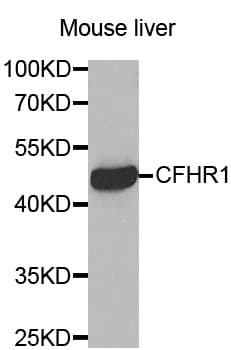 CFHR1 Antibody (aa151-330)