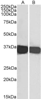 IHC-plus™ Polyclonal Goat anti-Human GAPDH Antibody (aa279-290, IHC, IF, WB)