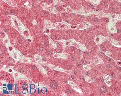 IHC-plus™ ADAMTS13 Antibody (aa1377-C-term)