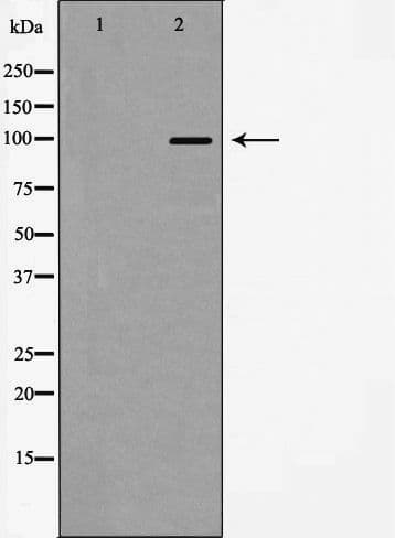 ACTN2 Antibody