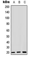 ZNF695 Antibody (Internal)
