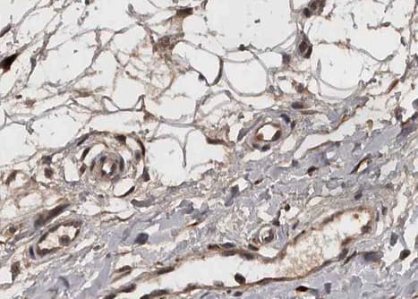 COL4A2 / Collagen IV Alpha2 Antibody