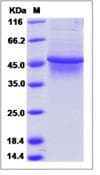 Human TAPBP / Tapasin Protein (Recombinant His,C-terminus)