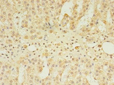 Polyclonal Rabbit anti-Human CSGALNACT2 Antibody (IHC, WB)