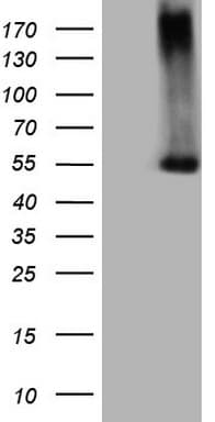 PROZ / Protein Z Antibody (aa115-400, clone OTI4A9)