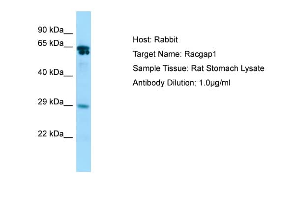 RACGAP1 / MGCRACGAP Antibody (C-Terminus)