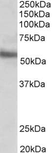 IHC-plus™ ERG Antibody (aa469-481)