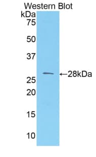 MCAM / CD146 Antibody (aa324-565)