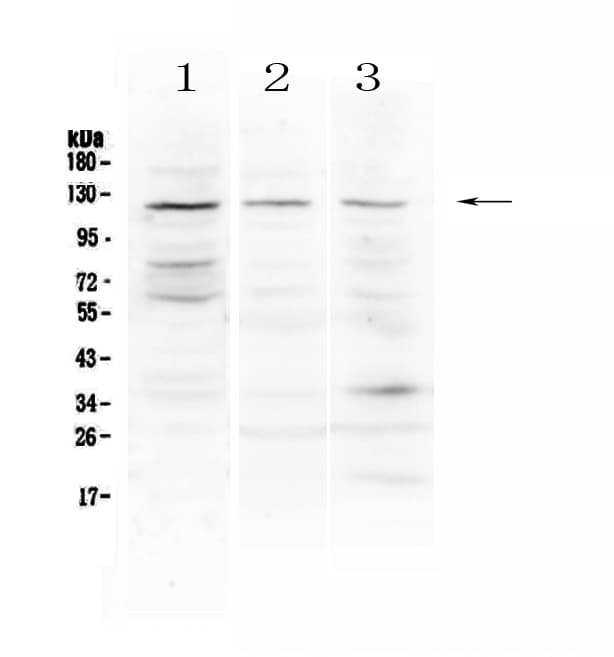 Polyclonal Rabbit anti-Human TLR3 Antibody (WB)