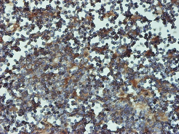Monoclonal Mouse anti-Human PSMB6 Antibody (clone 2A3-5A8, IHC, WB)