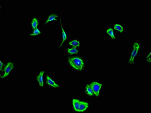 CNR2 / CB2 Antibody