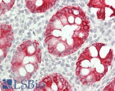 IHC-plus™ KRT19 / CK19 / Cytokeratin 19 Antibody (Internal)