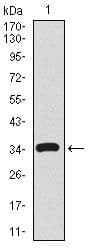 CD59 Antibody (Amino Acid: 31-111, clone 8D2B8)