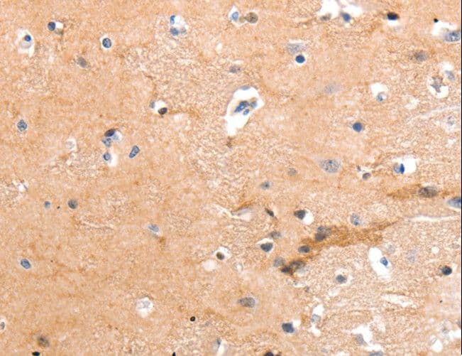 ADGRG2 / GPR64 Antibody