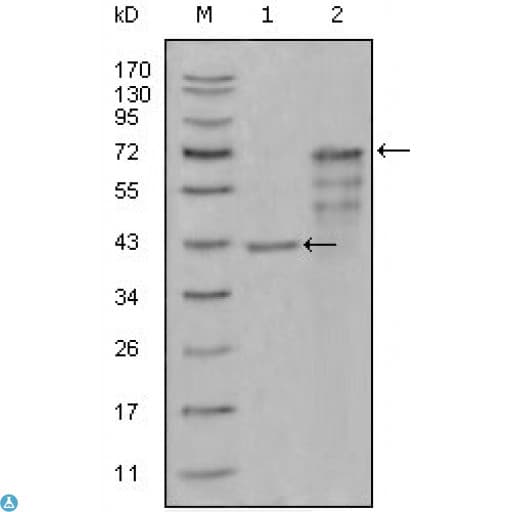 CHIT1 / Chitotriosidase Antibody