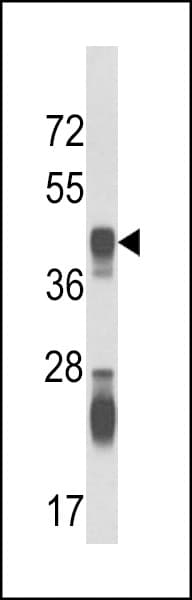 IHC-plus™ ASS1 / ASS Antibody (aa192-221)