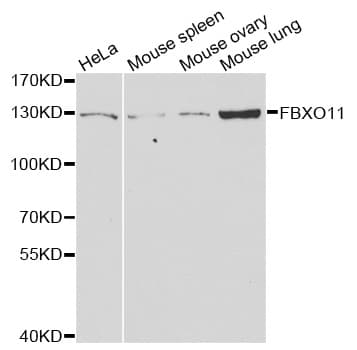 FBXO11 Antibody
