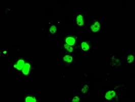 ARNT / HIF-1-Beta Antibody (clone OTI1D1)